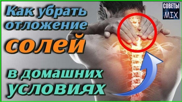 Как убрать отложение солей на шее раз и навсегда. Уникальный компресс для шеи в домашних условиях