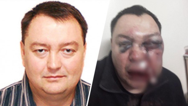 Избитый иркутский экс-депутат связал нападение с критикой губернатора