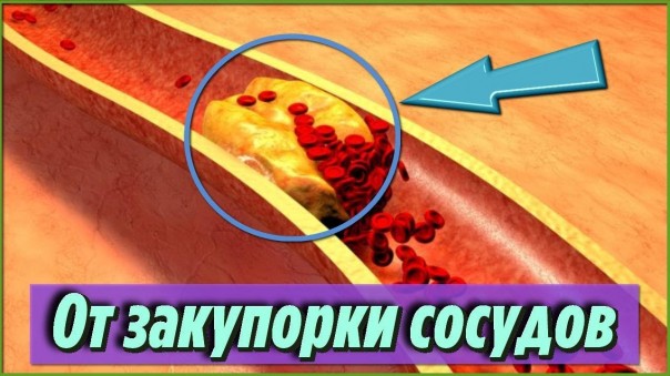 Самые лучшие продукты, которые предотвращают закупорку сосудов и артерий. Полезные советы для здоровья
