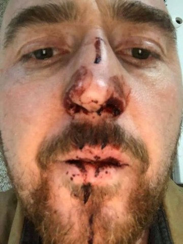 В Польше хозяин пиццерии жестоко избил украинского актера с Майдана