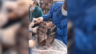 Врачи показали, как выглядят лёгкие после 30 лет курения — видео 18+