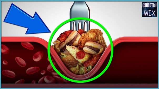 Продукты с самым высоким содержанием холестерина от которых стоит отказаться. Советы для здоровья