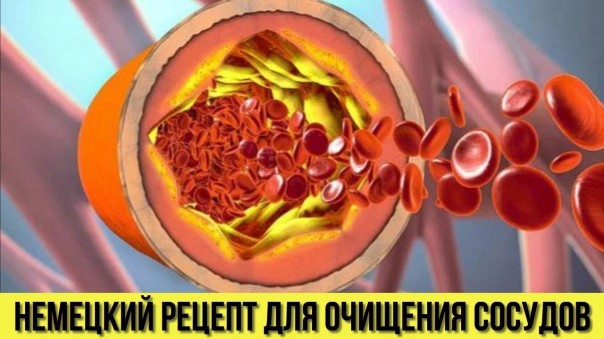 Проверенный немецкий рецепт для очищения сосудов. Это очень просто сделать в домашних условиях
