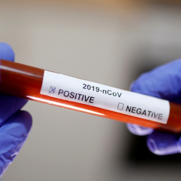 Конституция, кабмин, коронавирус... Дайджест российских новостей за 27 января - 2 февраля