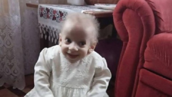 Восьмилетняя украинка умерла от преждевременного старения