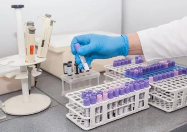 Число случаев заражения коронавирусом в России превысило 4,7 тысяч, в Москве за сутки заразились 14 детей