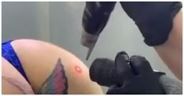 Болезненное исправление ошибки молодости