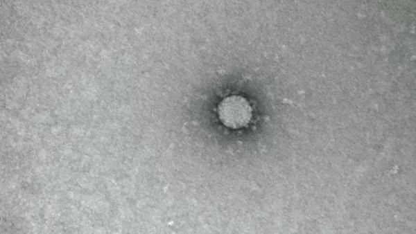 Ученые выяснили, при какой температуре гибнет коронавирус