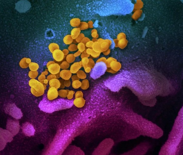 Испытан препарат, снижающий накопление коронавируса в 5000 раз