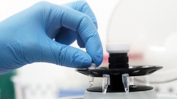 Россия отправила свои тест-системы на коронавирус в более чем 30 стран