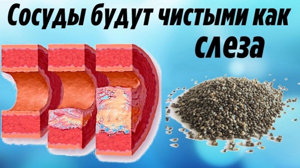 Сосуды и артерии будут как слеза. Вот что нужно есть каждый день, чтобы не возник атеросклероз