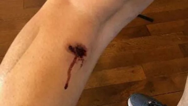 В США полицейские несколько раз выстрелили в продюсера Sputnik