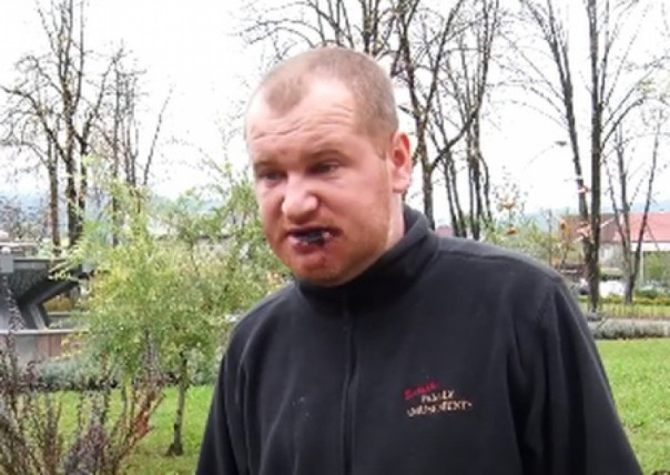 На Закарпатье избили кандидата от «Оппозиционной партии – За жизнь»