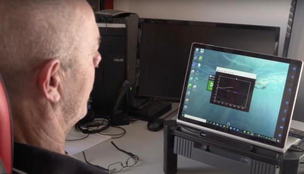 Человеческий мозг впервые подключили к компьютеру через вену без трепанации черепа