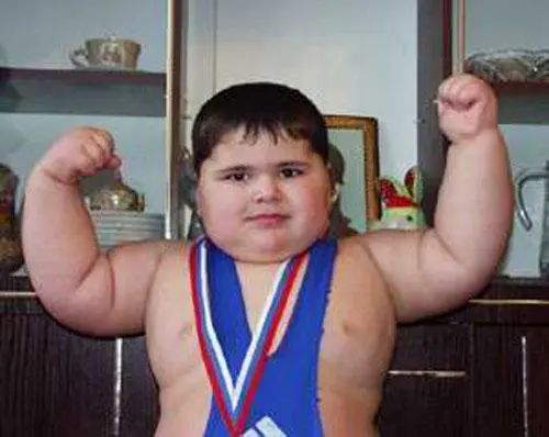 В России умер "самый большой ребенок в мире"