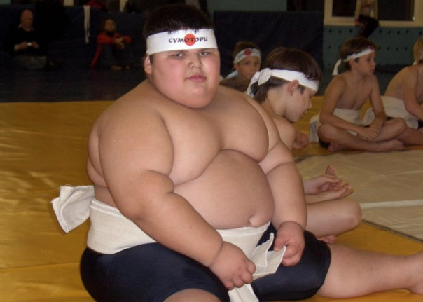 В России умер "самый большой ребенок в мире"