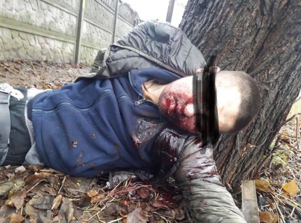 [18+] Взорвали петарду во рту: в Павлограде жестоко убили парня