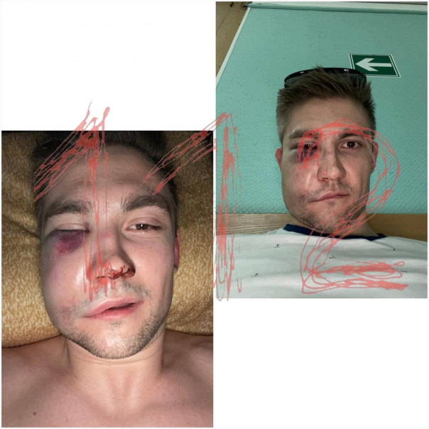 Известный актёр и либерал Александр Паль вместе со своими двумя друзьями избил хоккеиста в центре Москвы.