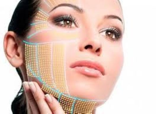 СМАС-лифтинг или Нитевой лифтинг?