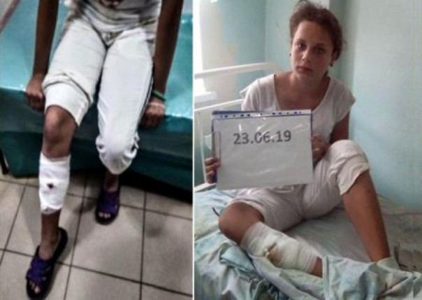 С крючка сняли смерть в Донбассе? Владимир Скачко