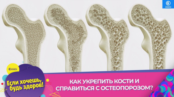 Как укрепить кости и справиться с остеопорозом. "Если хочешь, будь здоров!"
