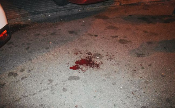 Не толпой, так со спины: в Краснодаре мигрант с ножом напал на охранника