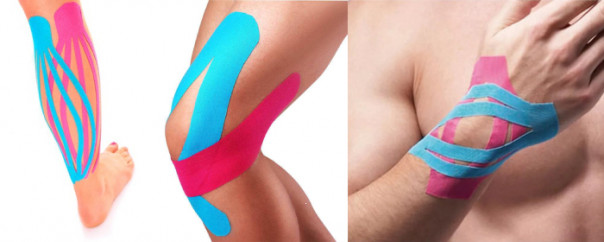 Кинезиотейпирование: показания, противопоказания, преимущества