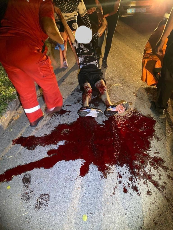 Под Киевом нарушителю комендантского часа прострелили ноги