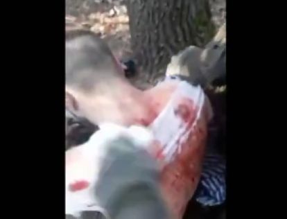 "Лишний балласт". Побратимы их бросили из-за ранений, а русские бойцы спасли