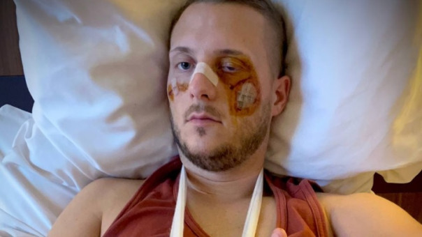 Переживший нападение французский волонтер обвинил спецслужбы Украины