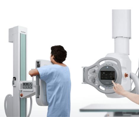 Переваги цифрового рентген-апарату и де його можно придбати