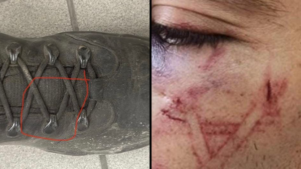 Израильские полицейские заклеймили палестинца звездой Давида