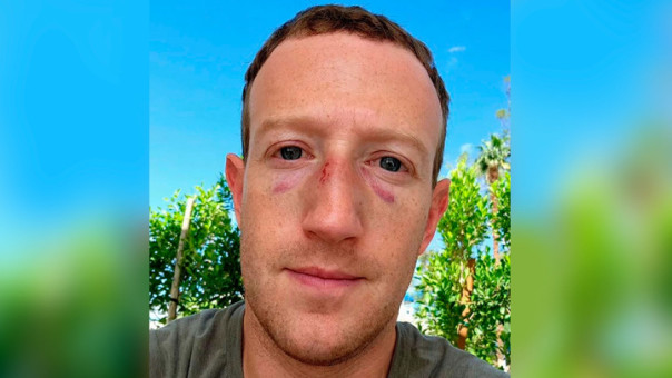 Цукербергу разбили лицо. Но это сделал не Маск