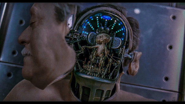 В мозгу Кеннеди-младшего нашли червя, сообщили СМИ