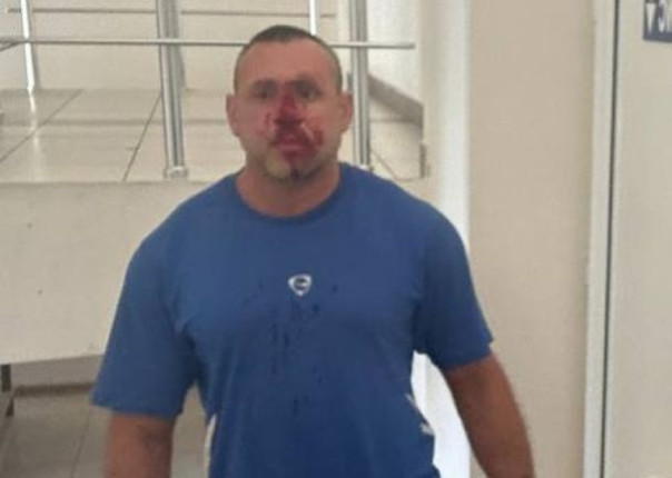 Одесский фитнес-тренер, которого насильно мобилизовали, признался, что его изнасиловали