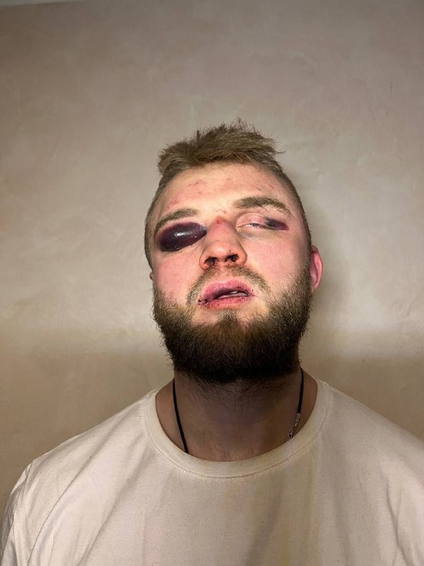 Украину ждёт «Нюрнбергский процесс-2». Нардепы рассказали о пытках в концлагере СБУ на весь мир