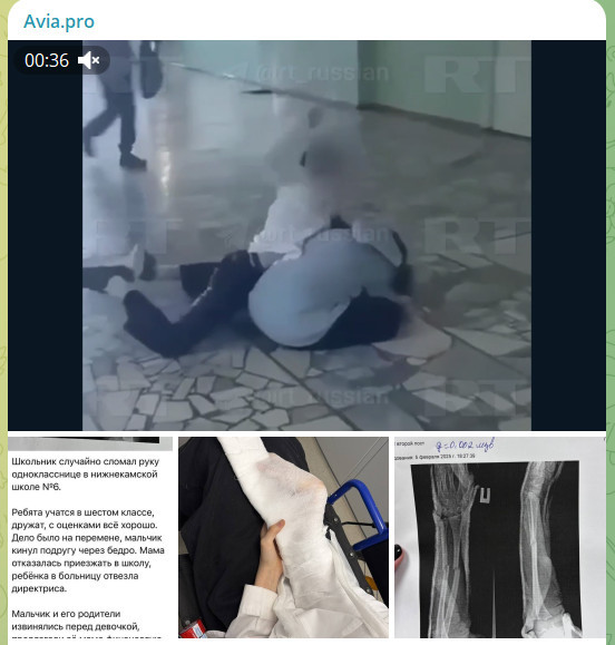 Мальчик из Узбекистана покалечил девочку в Нижнекамске. После в палату к ребёнку пришёл его отец