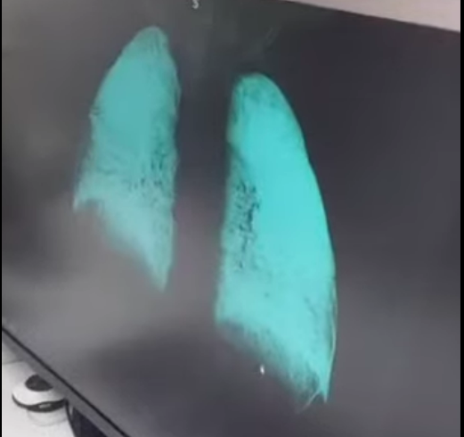 Последствия после нахождения в газотранспортной трубе