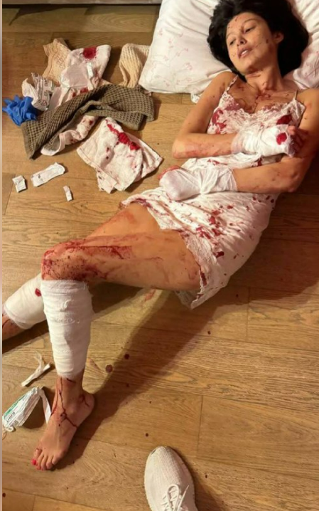 Главарь «Союза грузин в России» и экс- министр Мособласти переломал ноги своей возлюбленной, пока их дочь спала в соседней комнате