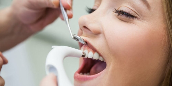 Чистота улыбки: как и зачем удалять зубные отложения