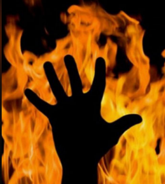 «Им головы обливали бензином и поджигали»