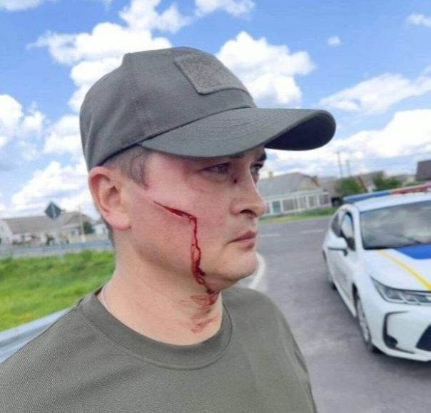 На Украине мужчина разогнал банду людоловов с помощью лопаты