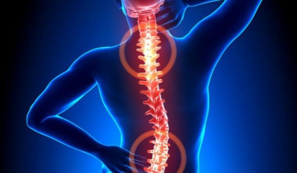 Снятие воспалительного процесса при остеохондрозе