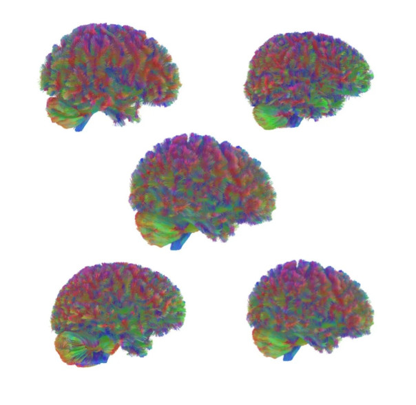 Британские ученые выяснили, что подростковый возраст заканчивается в 32 года, а старость начинается в 66 лет