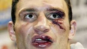 Кличко уже в нокауте от дебатов с Януковичем